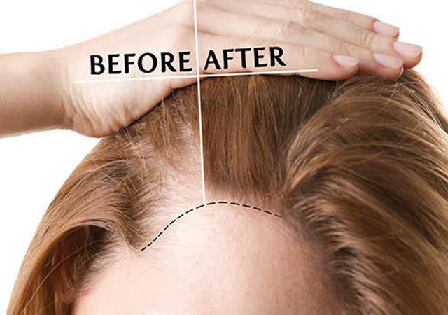 Hair Revive Before After